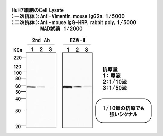 1次抗体検出試薬セット BCL-EZS21